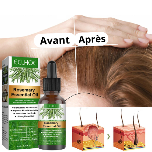 Mélange d'huile de romarin - Croissance des cheveux